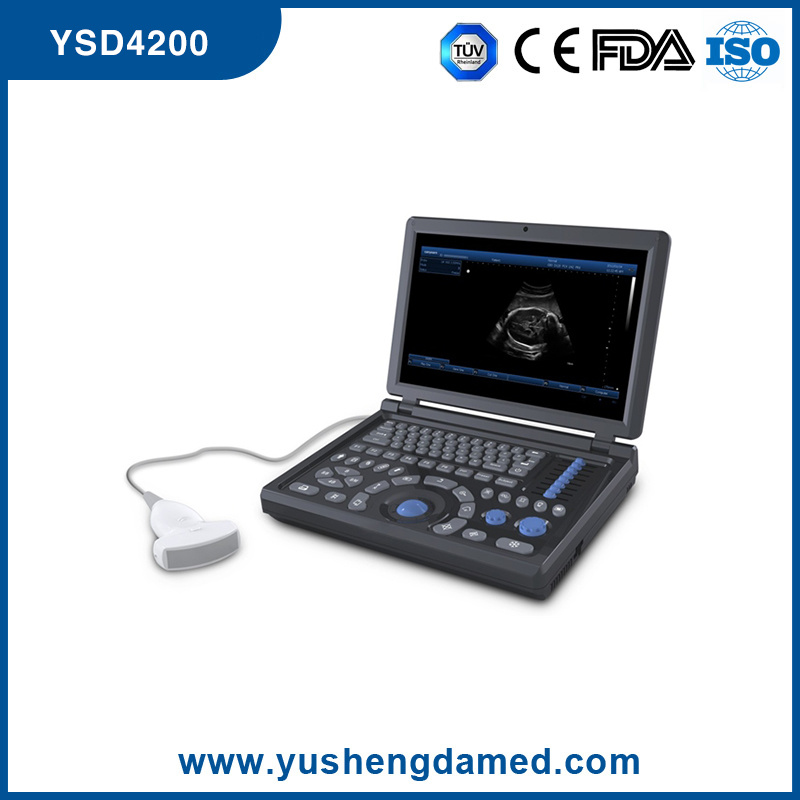 Ysd4200 Medical Equipment Laptop Digital Ultrasound with Ce ISO Approved
