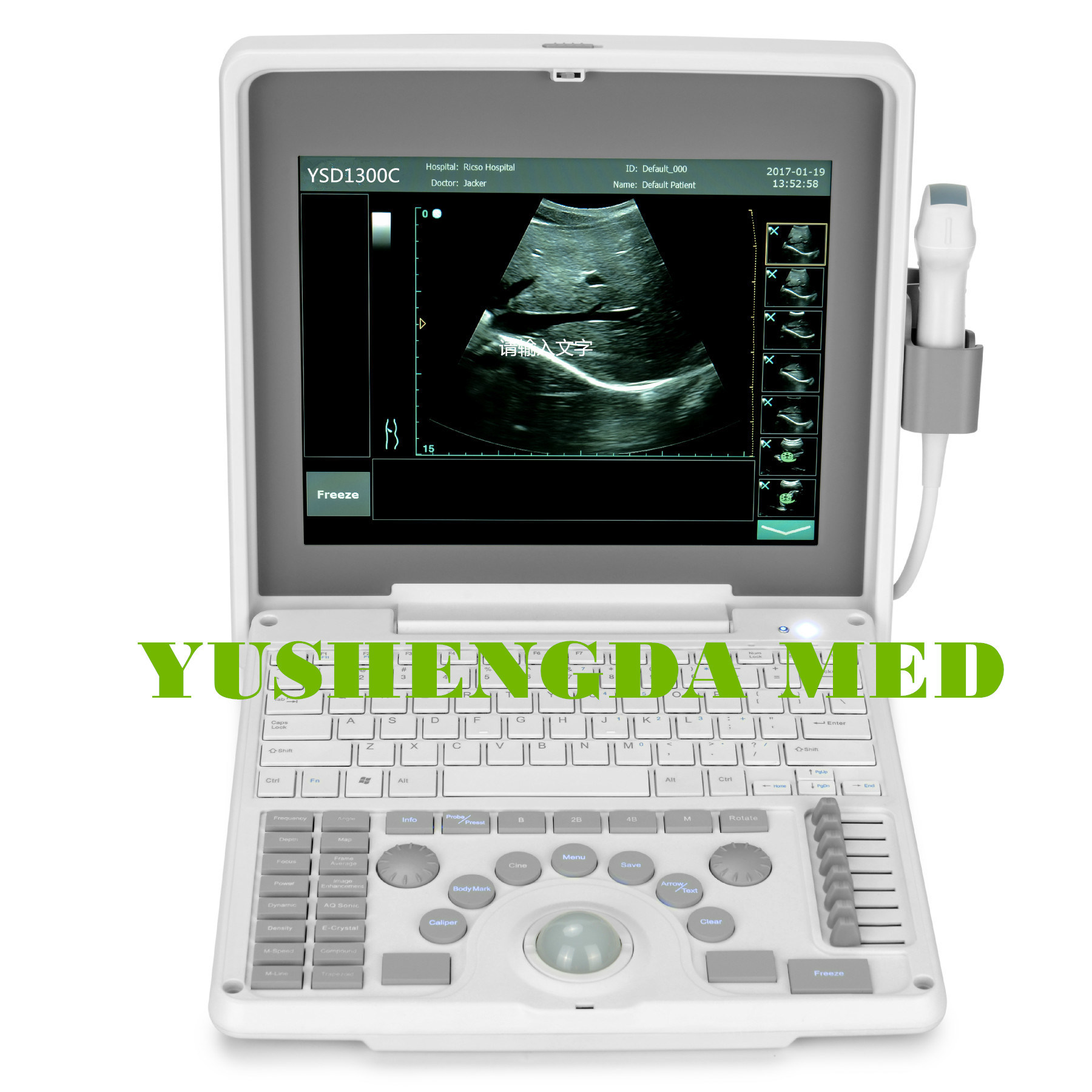 Ce Approved Excellent Image Quality Portable Ultrasound Scanner