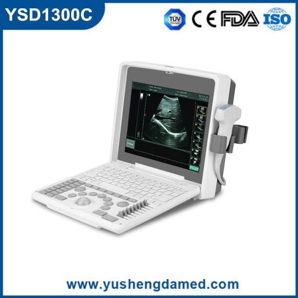 Ysd1300c High Quality Digital Portable Ultrasound Scanner