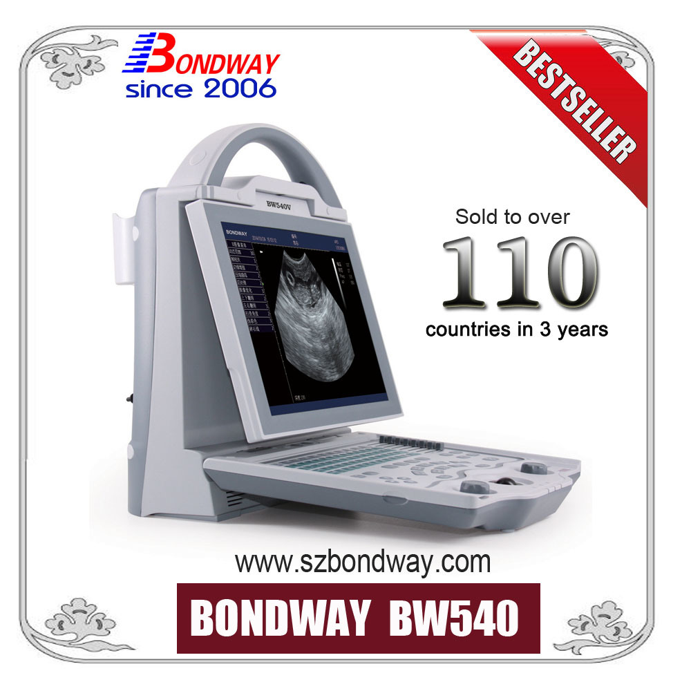 Best Price for Portable Ultrasound Scanner with LED Display, (BW540) Crystal Clear Image, Handcarry Ultrasound