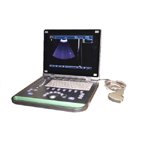 USB Laptop Full Digital Ultrasonic Diagnosis System