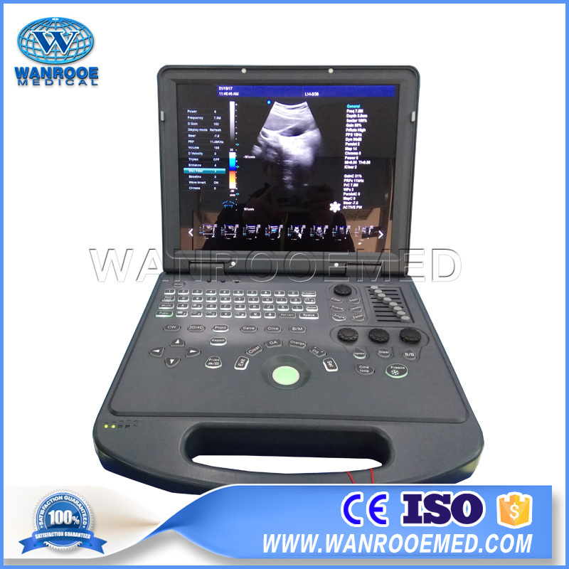 Usc60 Hospital Equipment Portable Pregnancy Color Doppler Ultrasound Scanner Machine