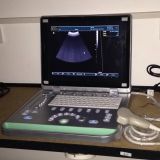 Full Digital Ultrasound Scanner with LCD Screen