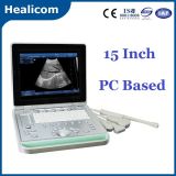 PC Based Laptop B/W Scanner Ultrasound (HBW-9)