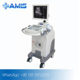 Imaging Diagnostic Ultrasound Scanner (Am-370)