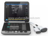 The Hottest High Quality Medical Equipment Diagnostic Ultrasound