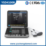 Ce/ISO Approved Portable Medical Ultrasound Scanner