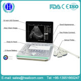 Medical Factory Laptop PC Based B/W Scanner Ultrasound Machine