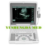 Ce Approved Excellent Image Quality Portable Ultrasound Scanner