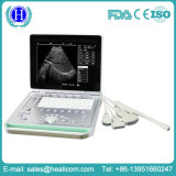 PC Based Laptop B Scanner Ultrasound