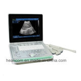 Hbw-9 PC Based Laptop Ultrasound B Scanner
