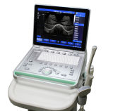 15inch Laptop Ultrasound Scanner