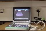 PC Laptop Silver Ultrasound Scanner