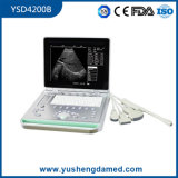 3D Crystal LED Screen Medical Diagnostic Machine Laptop Ultrasound Scanner