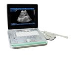15inch LED PC Based High Quality Laptop Ultrasound Scanner