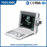 Ce Certified Medical Diagnostic Equipment Ultrasound Scanner