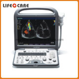 Sonoscape S8 Portable Color Ultrasound Doppler System 3D 4D Ultrasound Machine