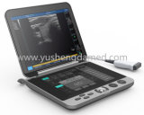 Medical/ Hospital Equipment Portable B/W Ultrasound Scanner