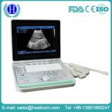 B Scanner PC Based Laptop Ultrasound Scanner Ultrasound Machine