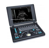 Ce Abdominal Digital Portable Ultrasound Scanner System Based PC