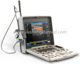Medical Equipment Digital Ultrasound 3D/4D Color Doppler Ultrasound