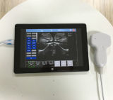 Crystal-Clear Image Ultrasound Machine USB Probe for Notebook and Tablet