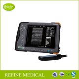 V5 Palm Imaging System Ultrasound Scanner