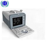 Very Popular Hbw-5plus Portable Ultrasound Machine Ultrasound Scanner Diagnostic System