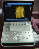 15inch LED Portable Laptop Ultrasound Scanner