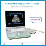 Cheapest Hbw-9 Laptop B/W Ulrasound Scanner Digital Portable Diagnostic Machine