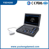Full Digital Laptop Diagnosis Ultrasound Equipment Ysd4200