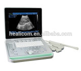 Portable Laptop Veterinary Ultrasound Euipment Vet Echo Ultrasound Machine for Animals (HV-9)