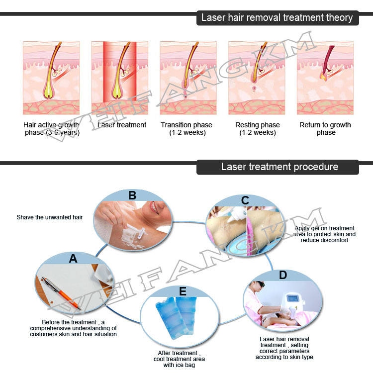 Professional Elight IPL Shr 808nm Diode Laser Hair Removal Machine