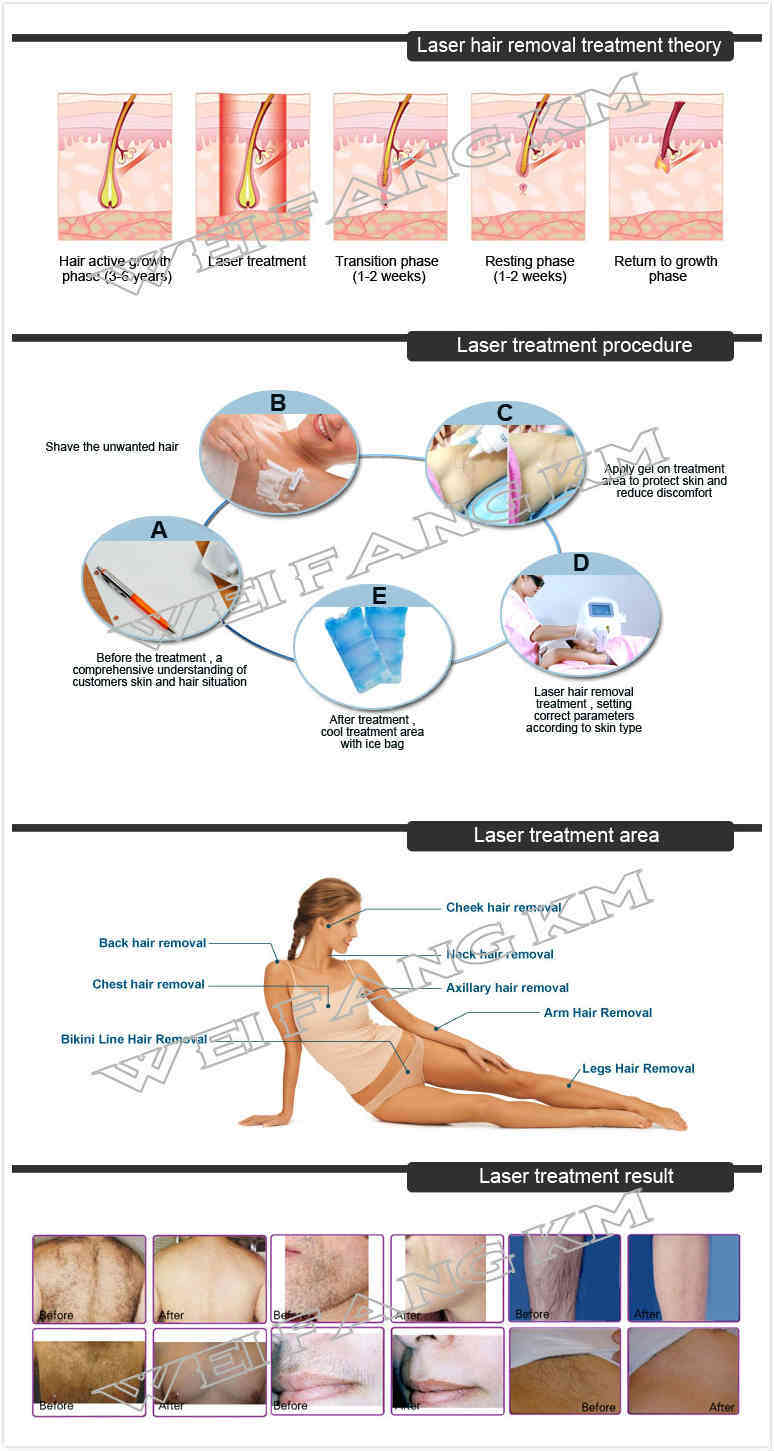 Newest IPL Laser Hair Removal Medical Beauty Machine