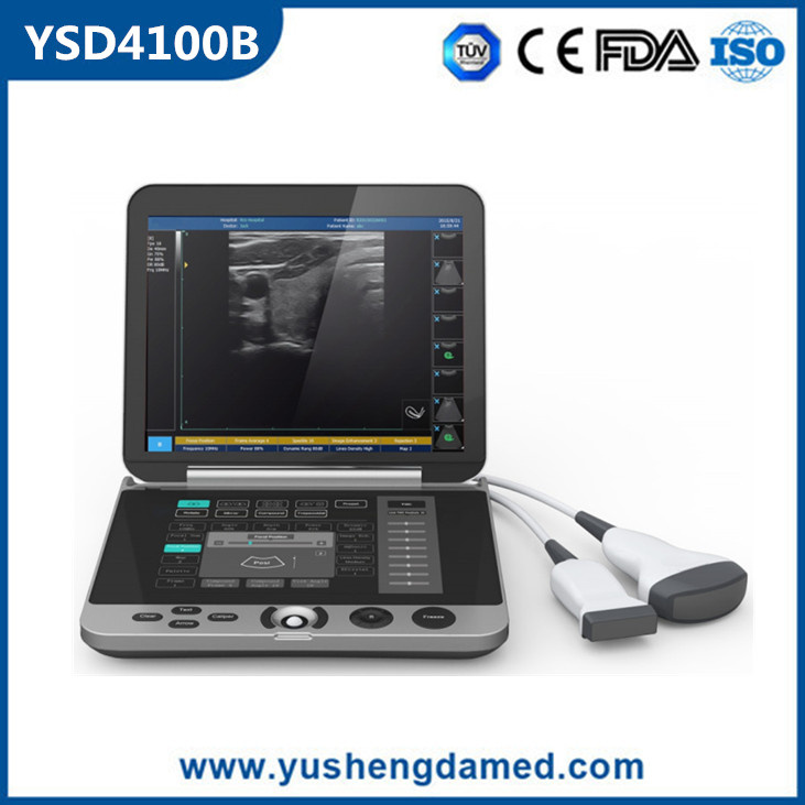 Ce/ISO Approved Portable Medical Ultrasound Scanner