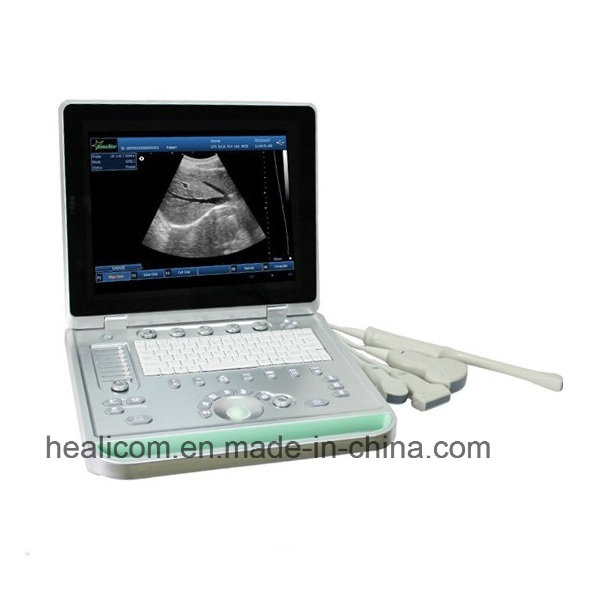 Hbw-9 PC Based Laptop Ultrasound B Scanner