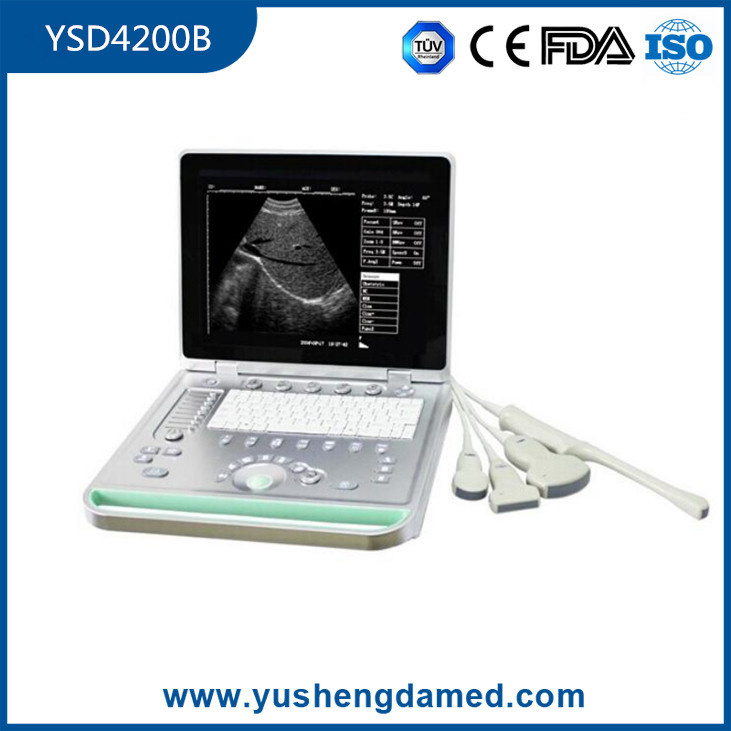 3D Crystal LED Screen Medical Diagnostic Machine Laptop Ultrasound Scanner
