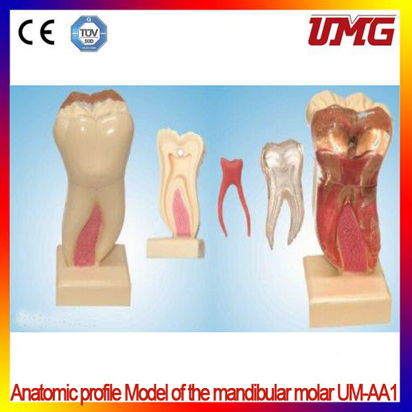China Dental Supplies Anatomic Profile Model of The Mandibular Molar