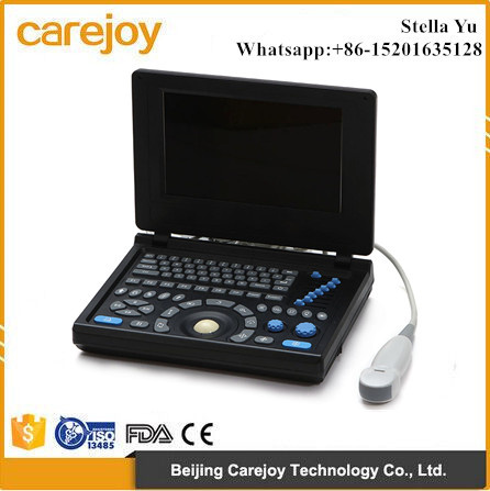 2016 New Laptop Ultrasound Scanner with 3D Function-Stella