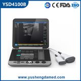 Ce/ISO Approved Portable Medical Ultrasound Scanner