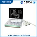 3D Crystal LED Screen Medical Diagnostic Machine Laptop Ultrasound Scanner