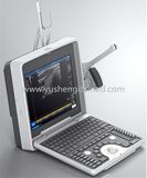 High Top Medical Equipment Portable Ultrasound