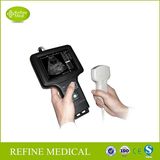 V6 Handle Imaging System Ultrasound Scanner