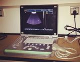 High Quality 15inch Color Laptop Ultrasonic Diagnosis Mahince