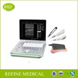 V7 Laptop Ultrasound Scanner