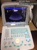 Ce Portable B Ultrasound Scanner