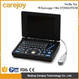 2016 New Laptop Ultrasound Scanner with 3D Function-Stella