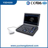 Digital Laptop Portable Ultrasound Machine with CE Approved Ysd4200